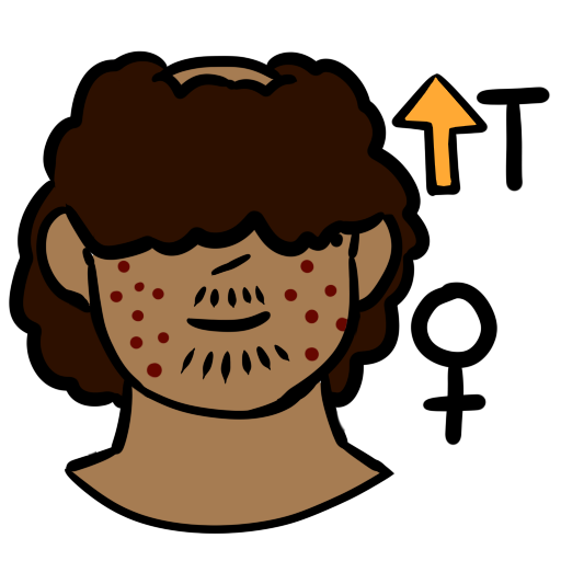 a person with light brown skin tone. They have acne, facial hair, and a bald spot on the top of their head. They have dark brown curly hair. In the upper left of the image is an orange up arrow next to the letter T. In the bottom left is a female symbol.